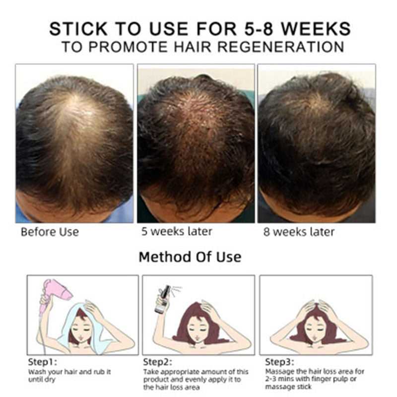 Hair Growth Oil Hair Growth Oil Oem Hair Care Essential Oil 