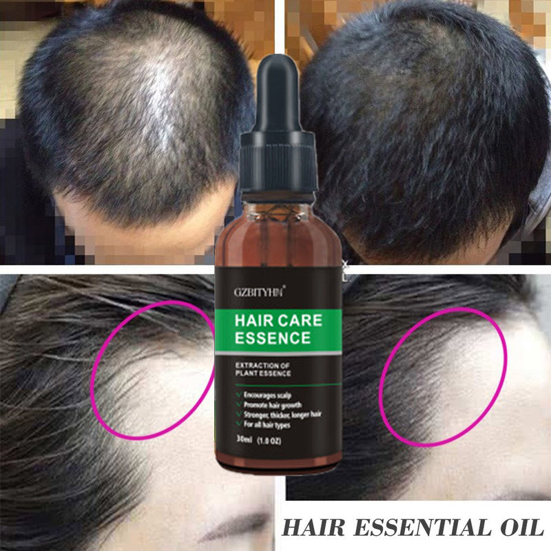 Hair Growth Oil Hair Growth Oil Oem Hair Care Essential Oil 