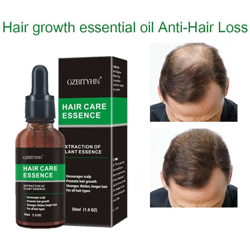 Hair Growth Oil Hair Growth Oil Oem Hair Care Essential Oil 