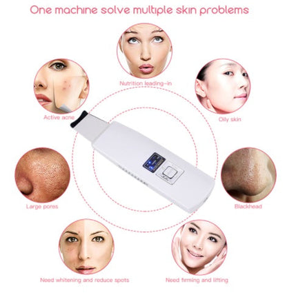 Ultrasonic Skin Scrubber Face Cleanser Blackhead Acne Removal Facial Spa Vibration Massager Ultrasound Peeling Clean Machine 394 