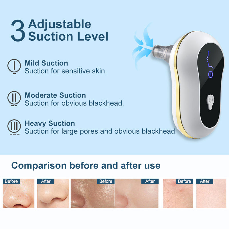 Suction Blackhead Remover Kit Electric Facial Pore Cleanser Acne Cleaner 