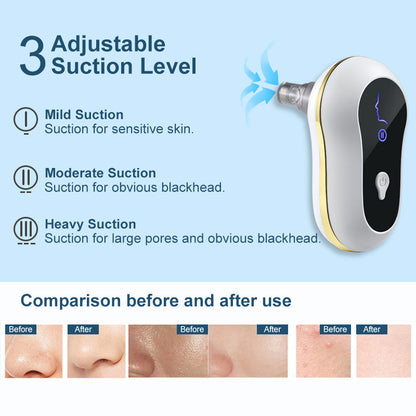 Suction Blackhead Remover Kit Electric Facial Pore Cleanser Acne Cleaner 