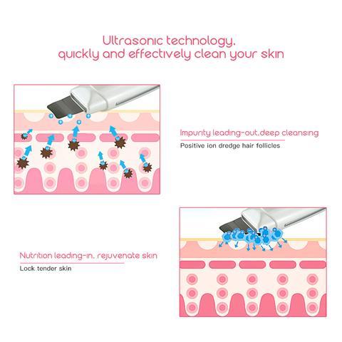 Ultrasonic Skin Scrubber Face Cleanser Blackhead Acne Removal Facial Spa Vibration Massager Ultrasound Peeling Clean Machine 394 